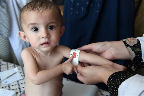 unicef administrative costs|Charity Watchdog Ratings .